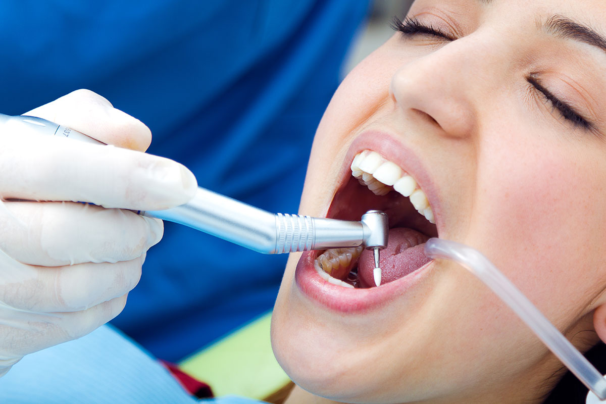 Limpieza Dental Pulido Dentistas Granada